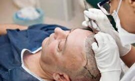 Hair Loss Treatment in Dubai: Consult a Trichology Expert