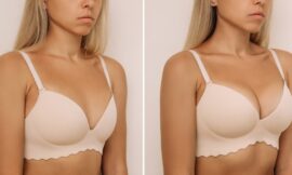 How Can I Minimize Scarring After Breast Augmentation in Dubai