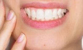 How to Relieve Pain After Teeth Cleaning: Essential Tips for Post-Cleaning Comfort