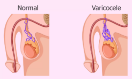 Erectile Dysfunction: A Holistic Approach to Recovery