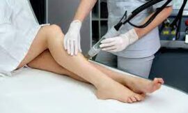 Best Laser Hair Removal Devices Now Available in Dubai