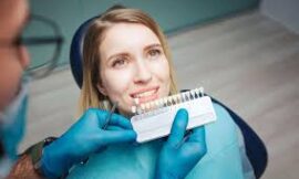 Smile Makeover: How Dental Veneers in Dubai Can Enhance Your Look