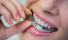 Invisalign Pain: What’s Normal and What Isn’t?