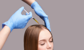 Is PRP Hair Treatment the Best Solution for Balding?