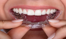 Cost of Invisalign: A Full Guide to Prices, Insurance, and More