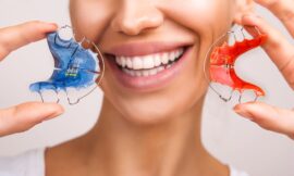 The Science Behind Dental Retainers