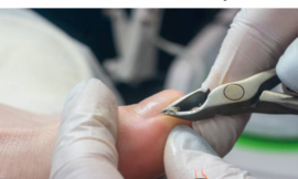 No.1 Podiatry Services in Scottsdale – Free Call Now!