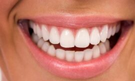 Say Goodbye to Stains: Teeth Whitening in Dubai Explained