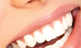 The Future of Teeth Whitening Cutting-Edge Treatments in Dubai