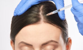 What Are the Benefits of Platelet Rich Plasma Hair Treatment for Hair Regrowth