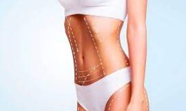 What Should I Eat Before and After Liposuction in Dubai to Ensure a Smooth Recovery