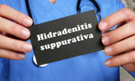 Living with Hidradenitis Suppurativa Tips for Managing the Condition