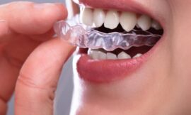 What Is Included in Invisalign Treatment Cost?