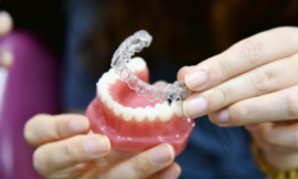 The Impact of Invisalign on Oral Health