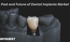 Dental Implants Market Size, Share, Growth Factors and Forecast 2025-2032