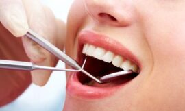 Does Teeth Cleaning Improve Gum Health?