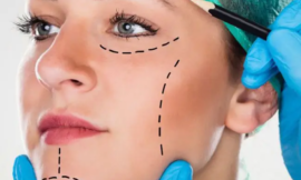 How Can You Minimize Scarring After Plastic Surgery in Dubai