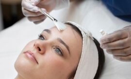 How to Prepare for a PCA Peel Treatment?