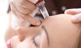 Mesotherapy Explained: How It Transforms Skin & Hair Health