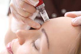 Read more about the article Mesotherapy Explained: How It Transforms Skin & Hair Health