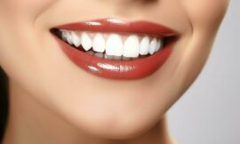 Teeth Whitening for a Fresh Start