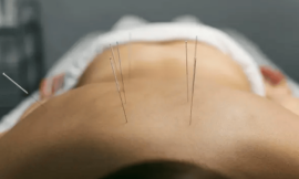 Acupuncture releases trapped emotions