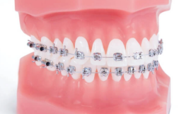 Achieve Your Perfect Smile with a Manassas Orthodontist