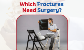 Which Fractures Need Surgery?