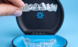 7 Invisalign Facts Everyone Needs to Know!