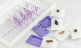 Unlocking the Potential of Cancer Tissue Blocks: A Comprehensive Guide