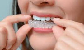 How to Get Straighter Teeth with Braces at the Ideal Age