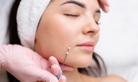 One Year Later: My Thread Lift vs. Botox Experience