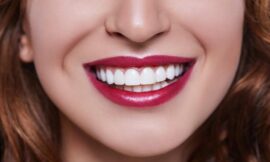Are Veneers in Dubai Suitable for Crooked Teeth