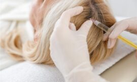 How Effective Is Prp Hair Treatment For Hair Restoration?