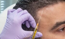 PRP Hair Treatment: Benefits and What to Expect