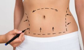 Can Men Benefit from a Tummy Tuck in Dubai, and What’s Different for Them