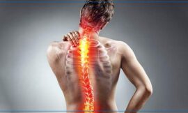 The Truth About Stenosis Pain: Symptoms and Triggers