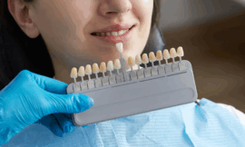 Enhance Your Smile with Cosmetic Crowns: The Ultimate Solution for Fragile Teeth in Louisville KY