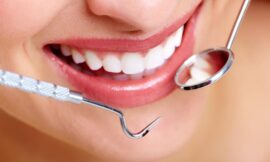 Natural-Looking Cosmetic Dental Work in Joondalup – What to Expect