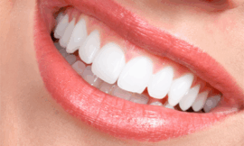 Dental Veneers: Transform Your Smile with This Treatment