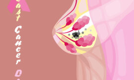 Does Family History Increase My Need for Breast Cancer Screening in Dubai