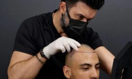Hair Transplant Recovery 2.0: Faster Healing with Cutting-Edge Solutions