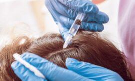 From Vial to Scalp: Why At-Home PRP Kits Are Dividing Experts