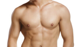 Is Gynecomastia Common Among Obese Men?