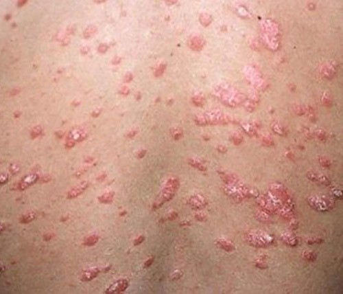 Read more about the article How Can I Tell If My Skin Allergy Is Caused by Pollution in Dubai