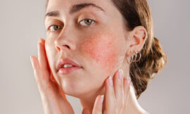 Is the Intense Dubai Sun the Reason Behind Your Skin Discoloration