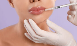 Lip Fillers Injections: Balancing Upper and Lower Lips