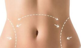 The Filtered Body: From Social Media to Surgery Tables