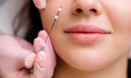 See Why Thread Lifts Are the Future of Anti-Aging