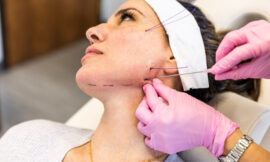 Which Works Better on Forehead Wrinkles—Botox or Thread Lift?